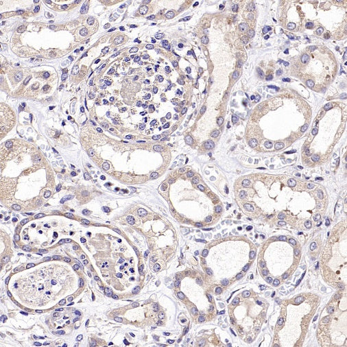 Rictor Recombinant Rabbit mAb (S-2601-26)