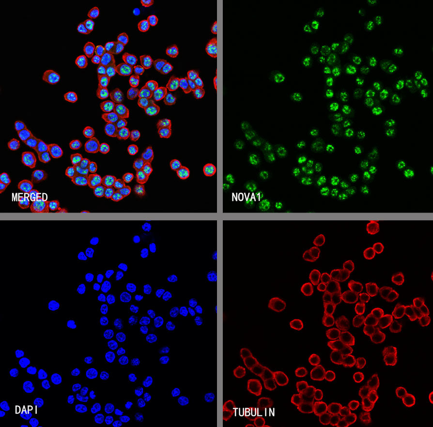 NOVA1 Recombinant Rabbit mAb (S-4031-71)