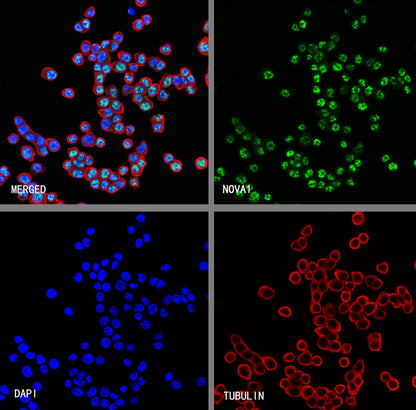 NOVA1 Recombinant Rabbit mAb (S-4031-71)
