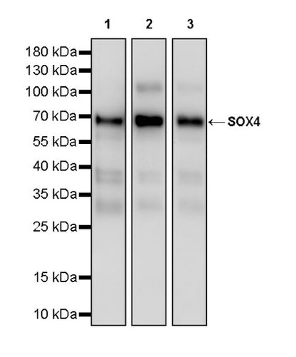 SOX4 Recombinant Rabbit mAb (S-2207-103)