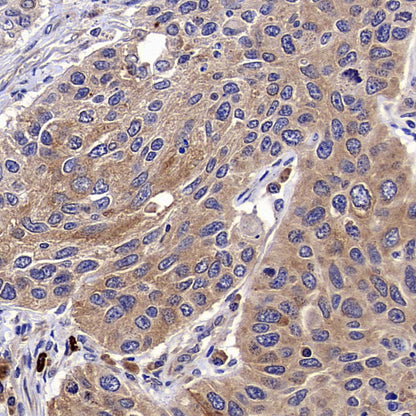 RPS14 Rabbit Polyclonal Antibody