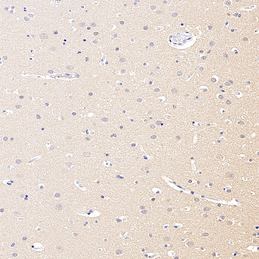 GPR153 Recombinant Rabbit mAb (S-4871-4)