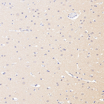 GPR153 Recombinant Rabbit mAb (S-4871-4)