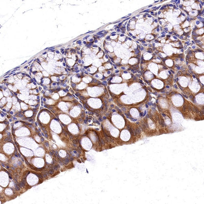 PKM2 Rabbit Polyclonal antibody