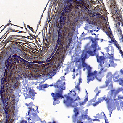Cytokeratin 1 Recombinant Rabbit mAb (SDT-3225-22)