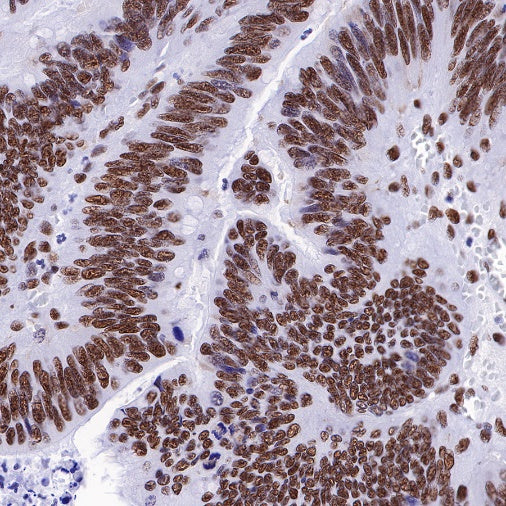 Ku80 Recombinant Rabbit mAb (S-R226)