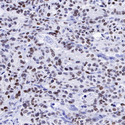 S-RMab®Topoisomerase I Recombinant Rabbit mAb (S-R209)