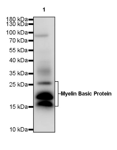 Myelin Basic Protein Recombinant Rabbit mAb (S-582-79)