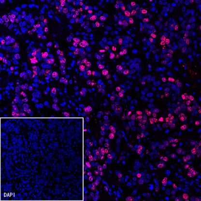 Ki67 Recombinant Rabbit mAb (Alexa Fluor® 555 Conjugate) (SDT-R459)