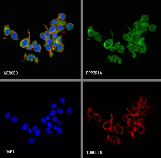 PPP2R1A Rabbit Polyclonal Antibody