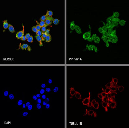 PPP2R1A Rabbit Polyclonal Antibody