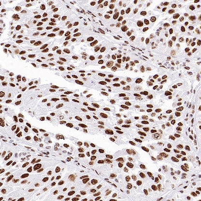 HSF1 Recombinant Rabbit mAb (S-3139-44)