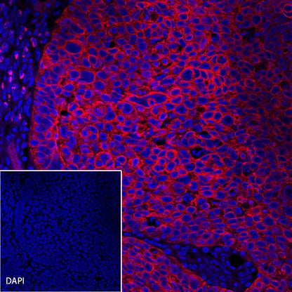 CK-Pan Recombinant Rabbit mAb (Alexa Fluor® 594 Conjugate) (S-P001)