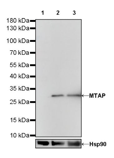 MTAP Recombinant Rabbit mAb (S-R363)