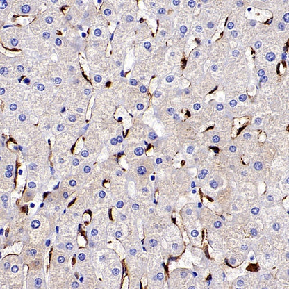 Mannose Receptor Recombinant Rabbit mAb (SDT-2206-59)