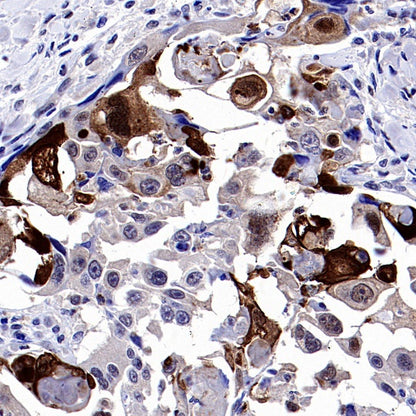 DARPP32 Recombinant Rabbit mAb (S-1637-62)