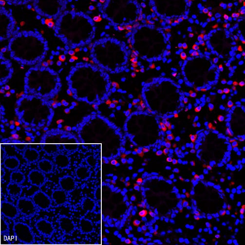 CD79a/MB-1 Recombinant Rabbit mAb (Alexa Fluor® 555 Conjugate) (S-030-18)