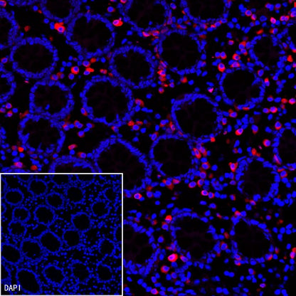 CD79a/MB-1 Recombinant Rabbit mAb (Alexa Fluor® 555 Conjugate) (S-030-18)