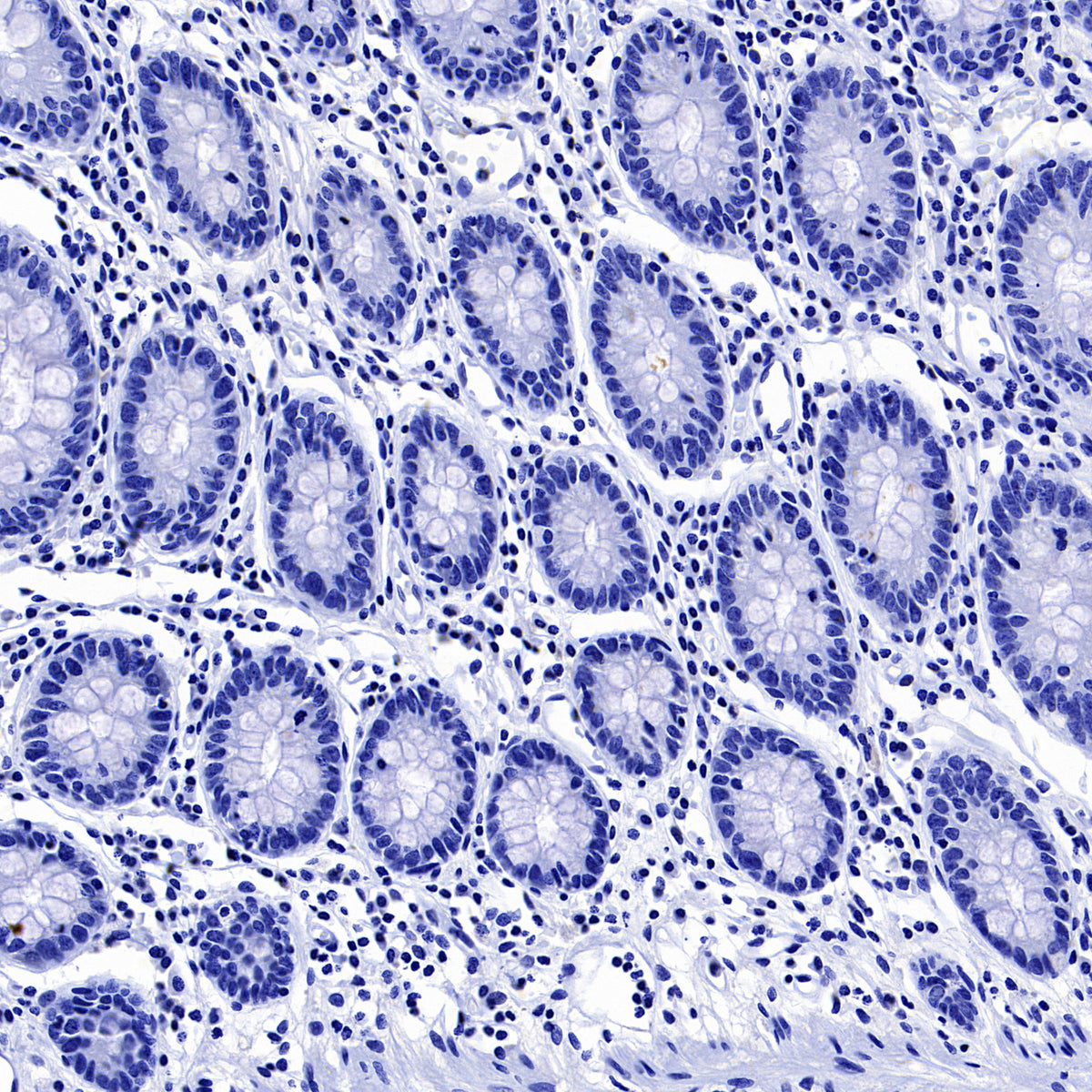 NOD2 Recombinant Rabbit mAb (SDT-3245-112)