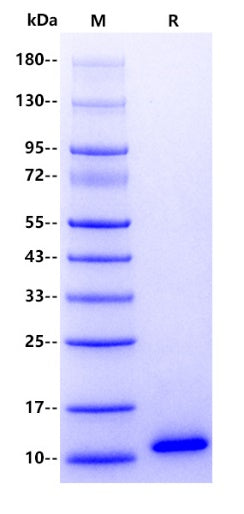 Human CCL8 Protein, His Tag