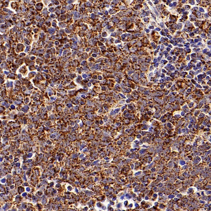 ATPB Rabbit Polyclonal Antibody