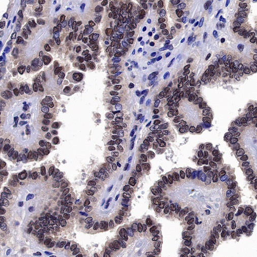 Helios Recombinant Rabbit mAb (S-1299-31)