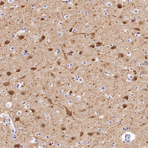 Synaptopodin Recombinant Rabbit mAb (SDT-3331-4)