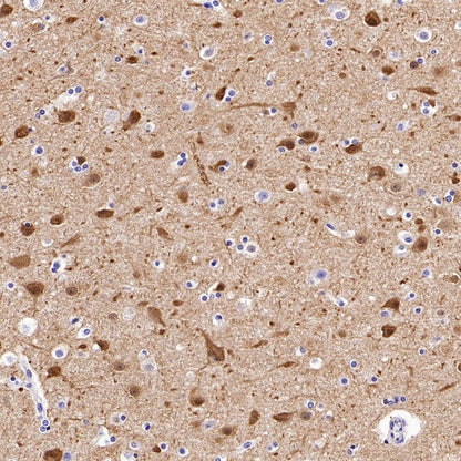Synaptopodin Recombinant Rabbit mAb (SDT-3331-4)