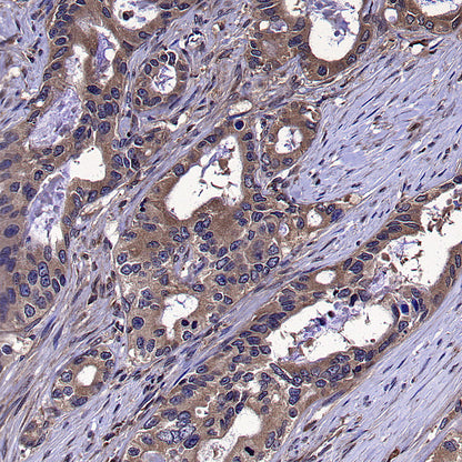 DOCK11 Recombinant Rabbit mAb (S-4420-57)