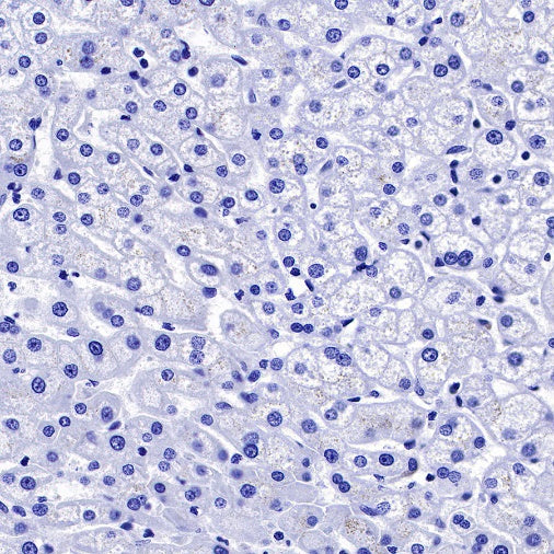 TrkB Recombinant Rabbit mAb (S-488-5)
