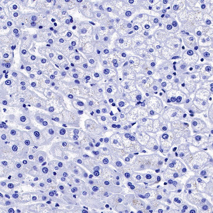 TrkB Recombinant Rabbit mAb (S-488-5)