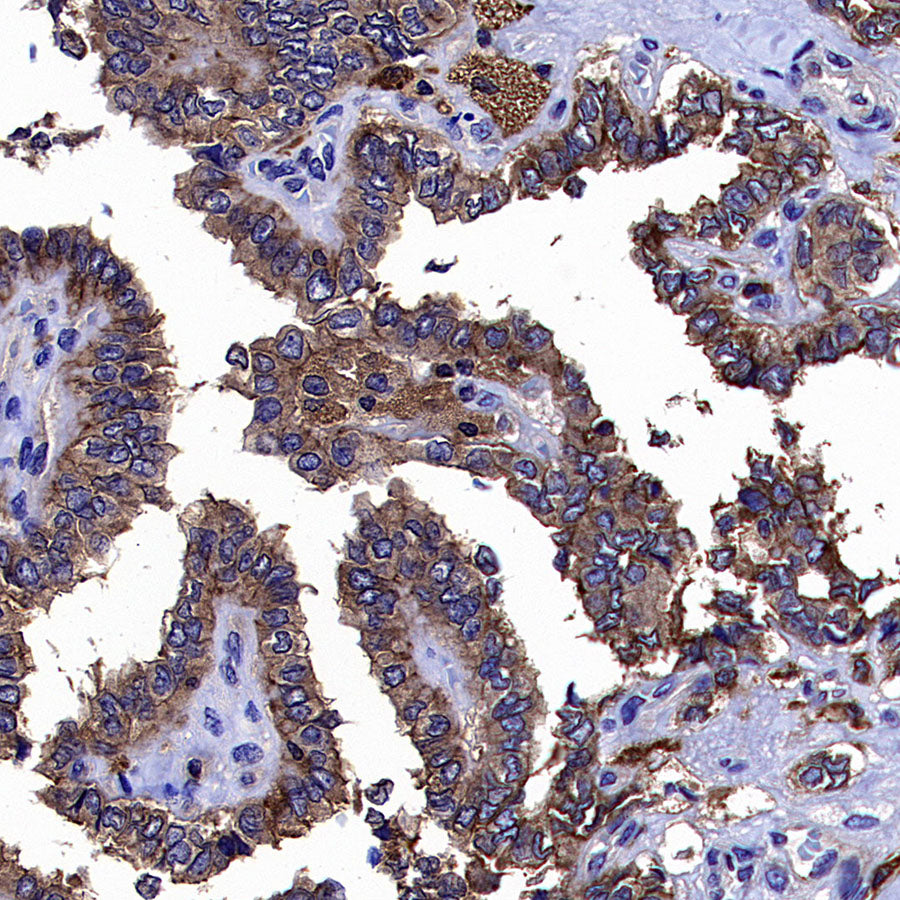 ARF6 Recombinant Rabbit mAb (S-4283-62)