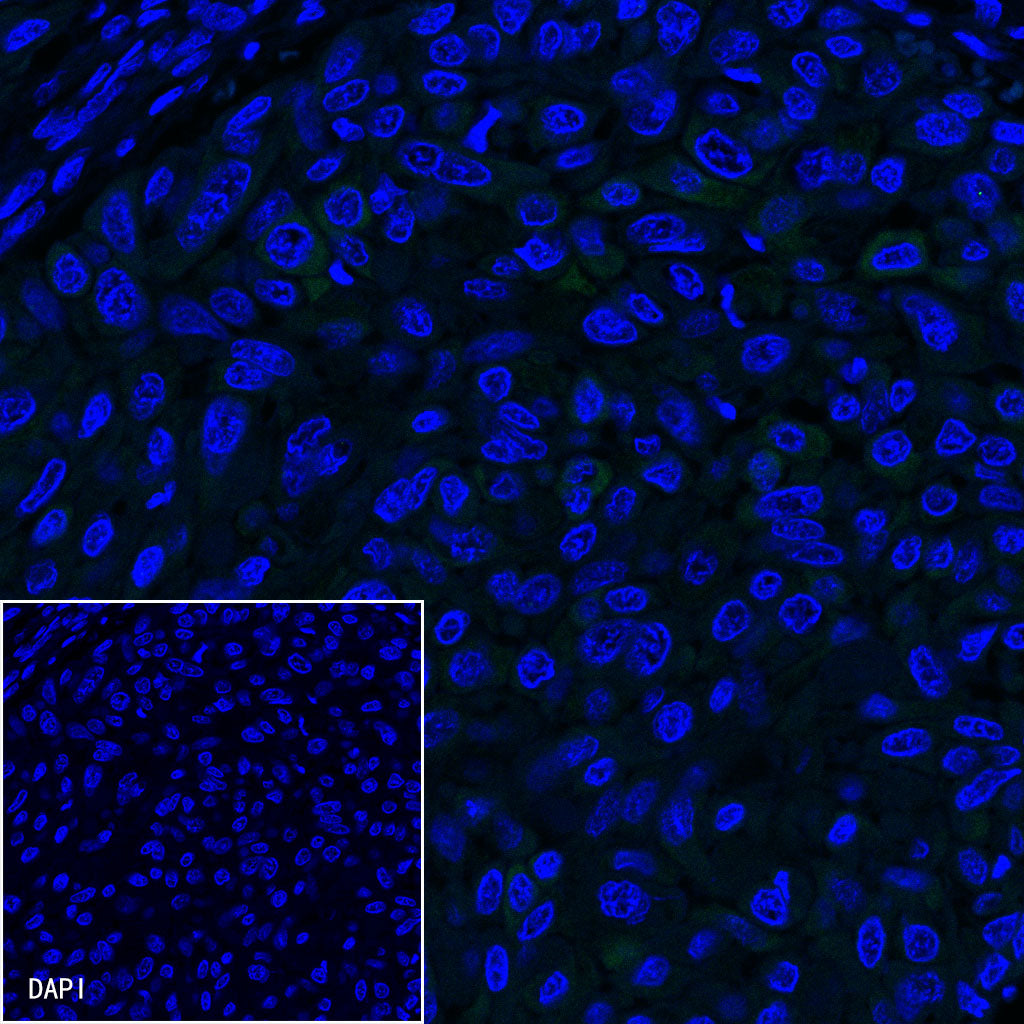 CK-LMW Recombinant Rabbit mAb (SDT-P003)