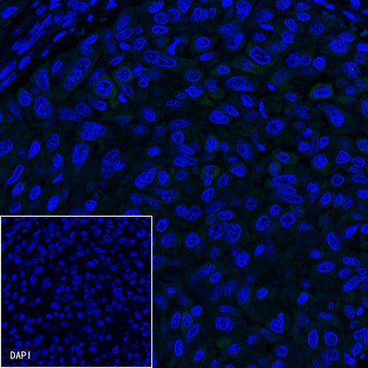 CK-LMW Recombinant Rabbit mAb (SDT-P003)