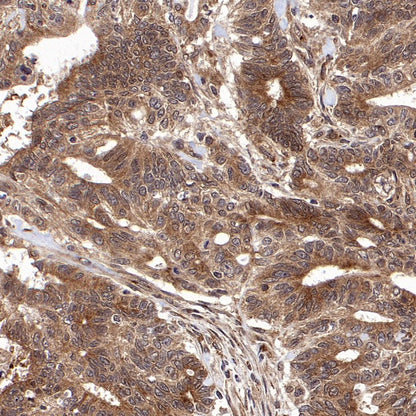 ISL2 Rabbit Polyclonal Antibody