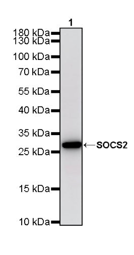 SOCS2 Recombinant Rabbit mAb (S-4956-21)