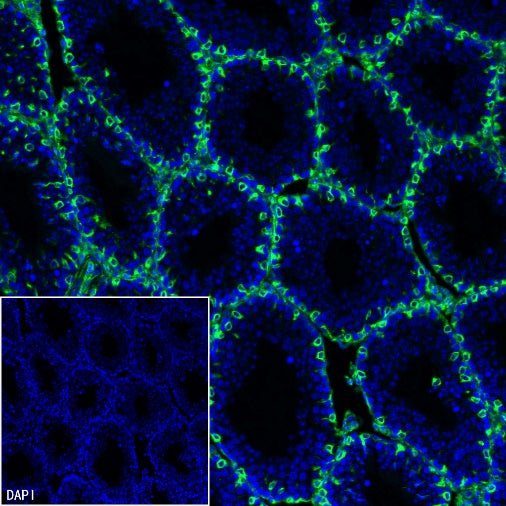 Vimentin Recombinant Rabbit mAb (Alexa Fluor® 488 Conjugate) (S-029-20)