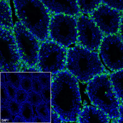 Vimentin Recombinant Rabbit mAb (Alexa Fluor® 488 Conjugate) (S-029-20)