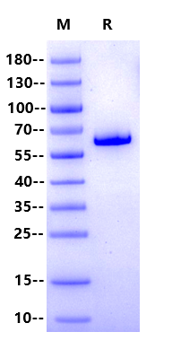 Prolactin R/PRLR His&Fc Tag Protein, Human