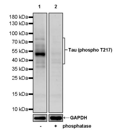 Tau (phospho T217) Recombinant Rabbit mAb (S-176-213)