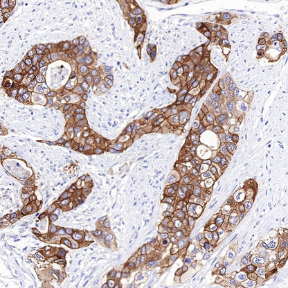TRIM29 Recombinant Rabbit mAb (S-642-43)