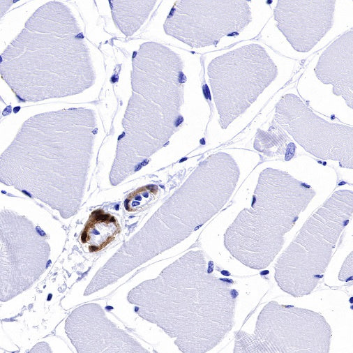Calponin-1 Recombinant Rabbit mAb (S-R161)