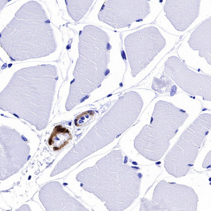 Calponin-1 Recombinant Rabbit mAb (S-R161)