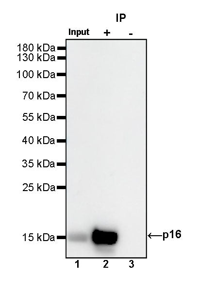 p16 Recombinant Rabbit mAb (SDT-303-206)