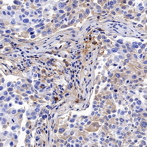 C1QB Recombinant Rabbit mAb (S-1248-314)