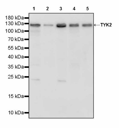 TYK2 Recombinant Rabbit mAb (S-2740-165)