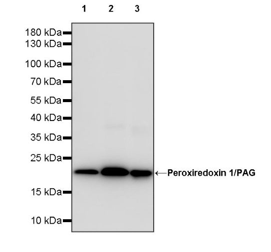 Peroxiredoxin 1/PAG Recombinant Rabbit mAb (S-1673-22)