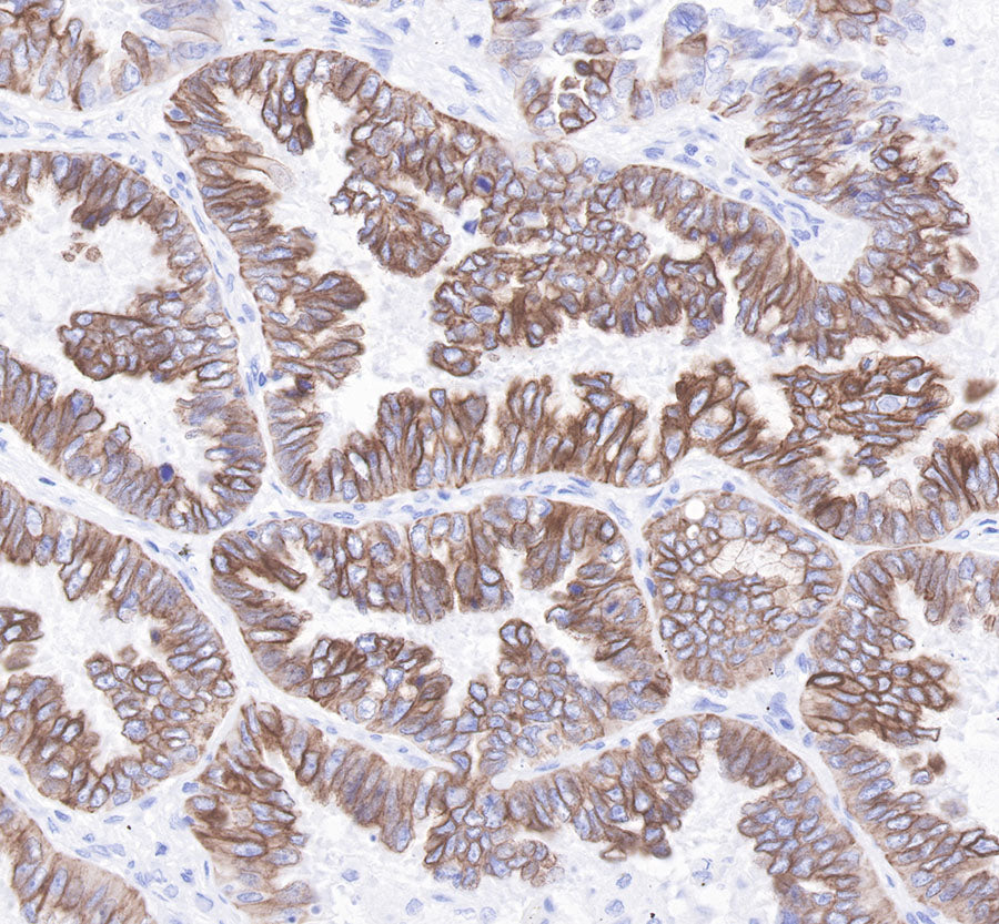 S-RMab® Cytokeratin 7 Recombinant Rabbit  mAb,PBS Only (SDT-121-17)
