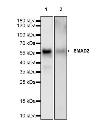 SMAD2 Recombinant Rabbit mAb (S-1420-20)
