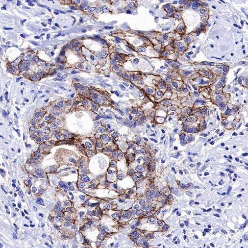 CD49f Recombinant Rabbit mAb (S-1019-73)